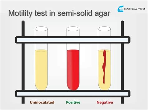 use of test tube with soft agar|Motility Test Medium Protocol .